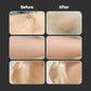 ALLONGS Korean Spa Body Peeling Pad (Hard / Pore Control / Soft)