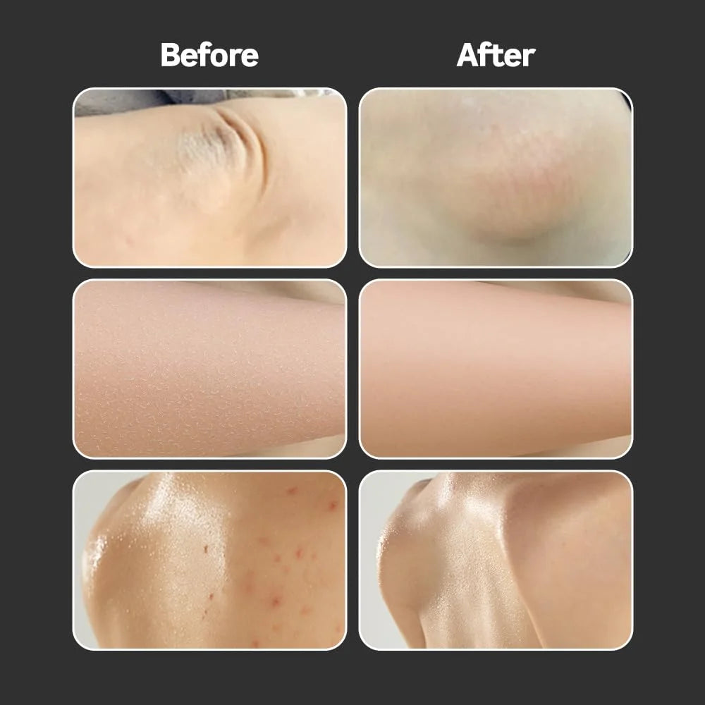 ALLONGS Korean Spa Body Peeling Pad (Hard / Pore Control / Soft)