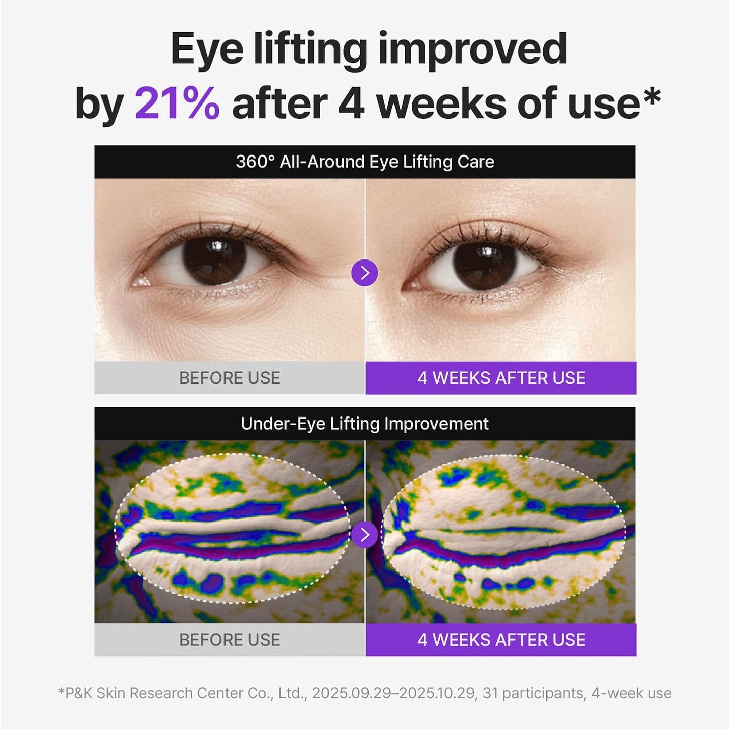 CENTELLIAN24 360 Shot PDRN Lifting Eye Cream 30ml