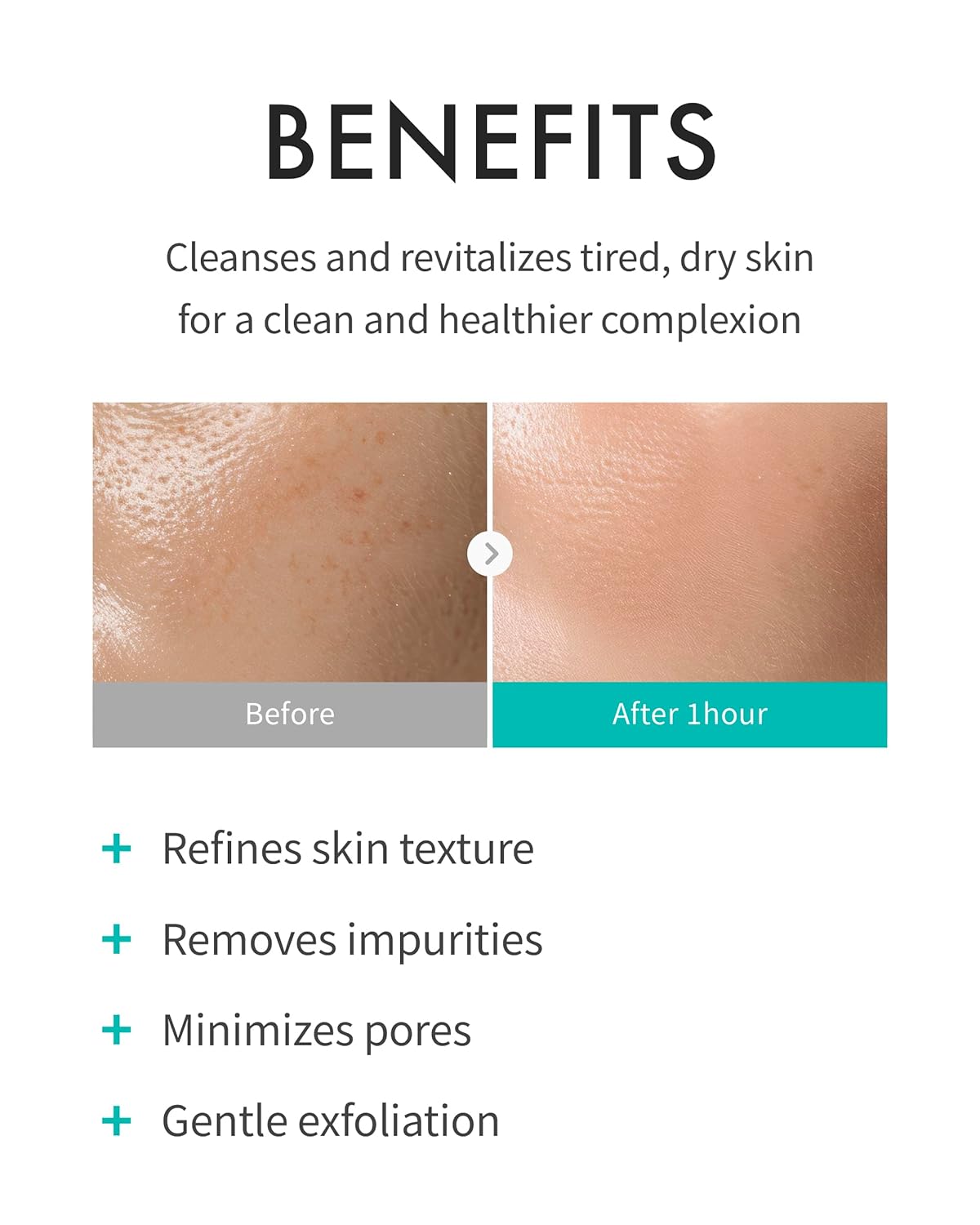 REJURAN Refining Foam Cleanser 120ml