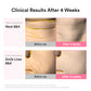 ABIB PDRN Volume Fill-It Booster 2.5 Tube 30ml