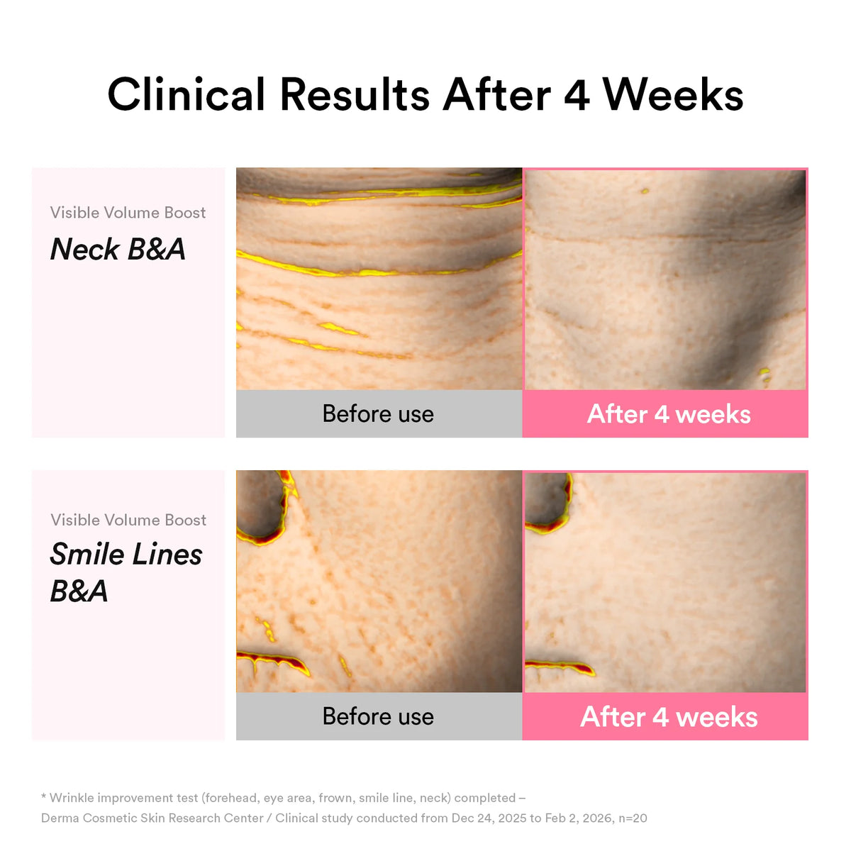 ABIB PDRN Volume Fill-It Booster 2.5 Tube 30ml