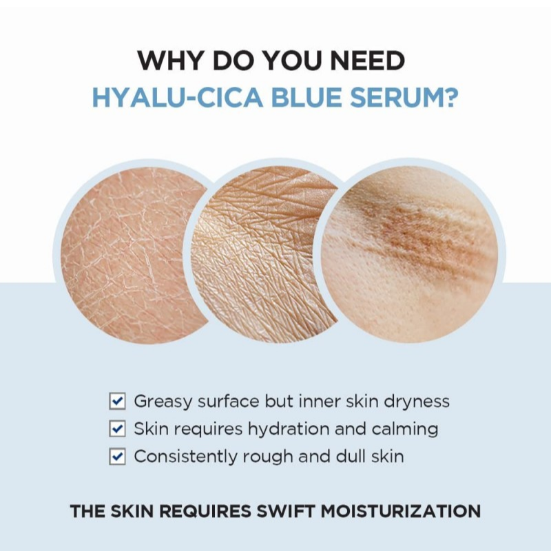SKIN1004 Madagascar Centella Hyalu-Cica Sunsational Kit