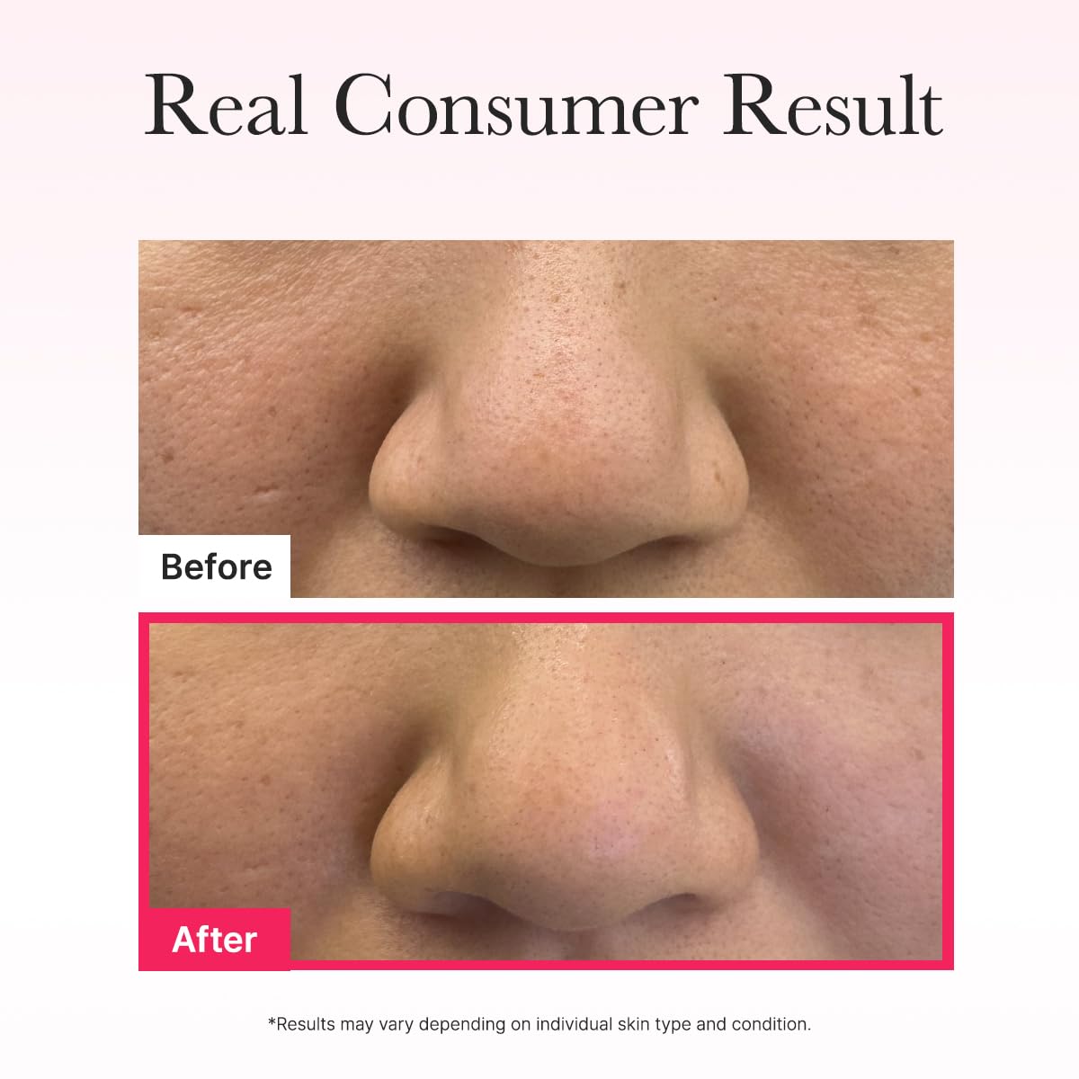 ARENCIA Red Collagen Jello Mask 25g