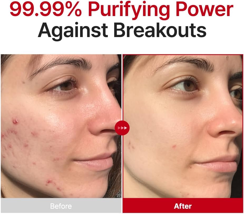 PURITO Hypochlorous Acid Rescue Spray 100ml