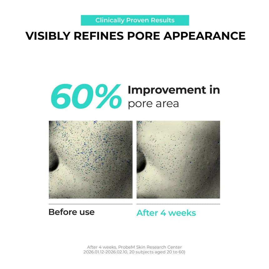 JUMISO Overnight Zero Pore Nose Patch (10patches)