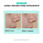 JUMISO Overnight Zero Pore Nose Patch (10patches)