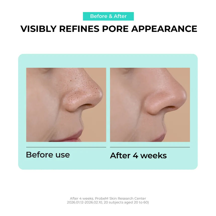 JUMISO Overnight Zero Pore Nose Patch (10patches)