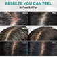 LILYEVE Scalp Turn Cica PDRN Deep Clean Shampoo 500g