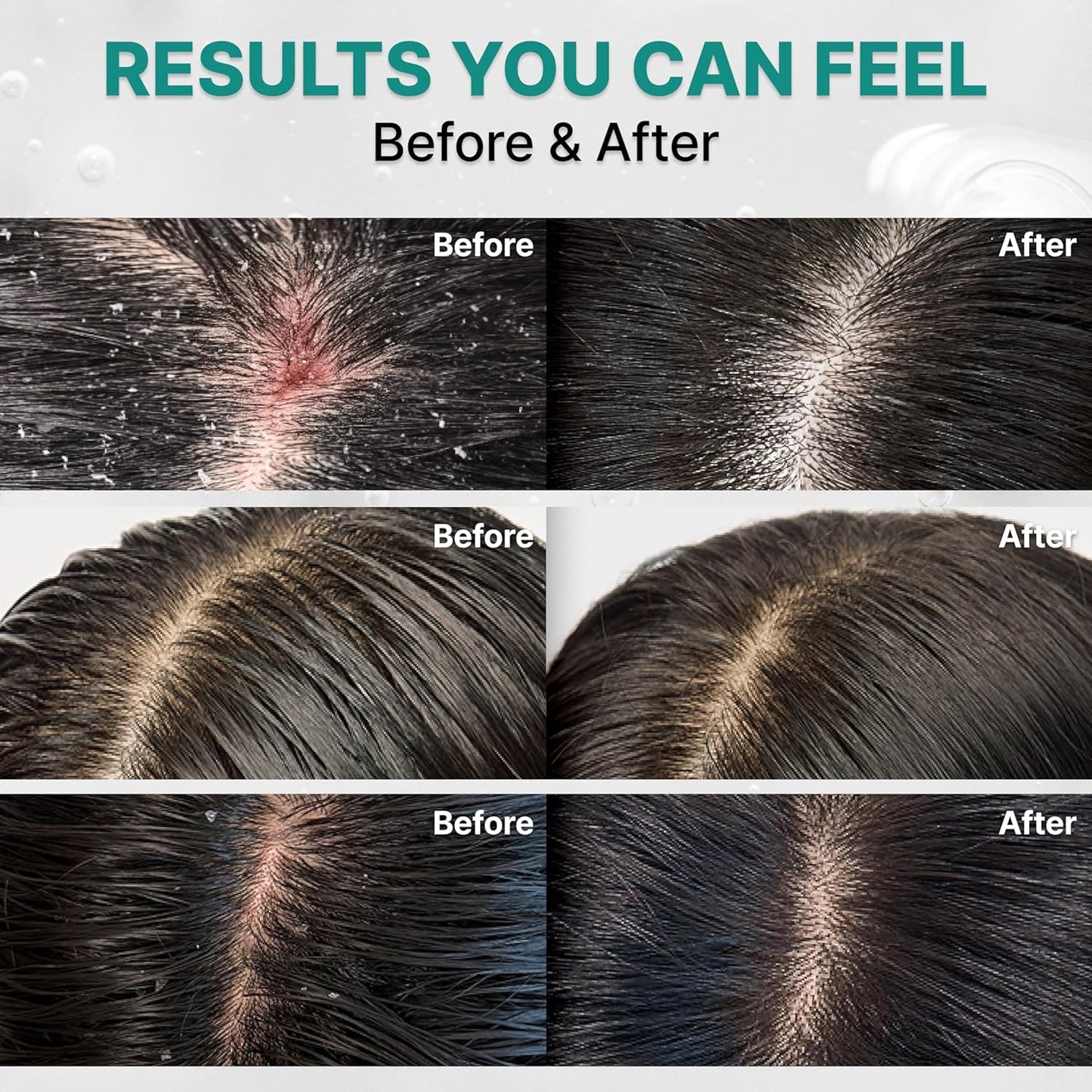 LILYEVE Scalp Turn Cica PDRN Deep Clean Shampoo 500g