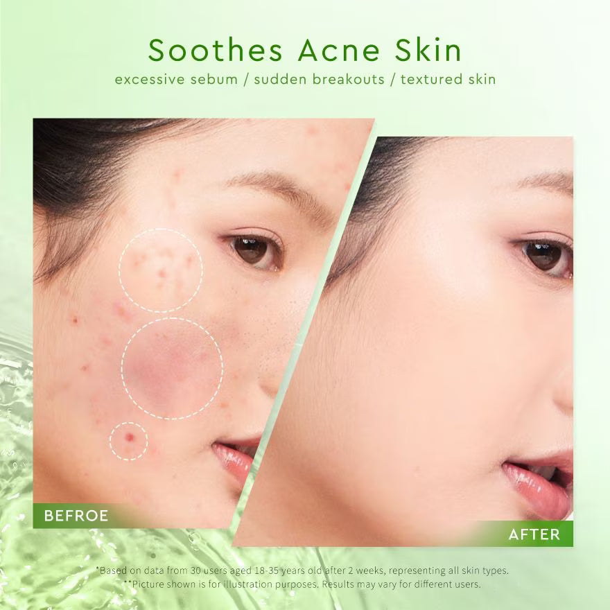 GLAD2GLOW Mugwort Acne Gel Mask