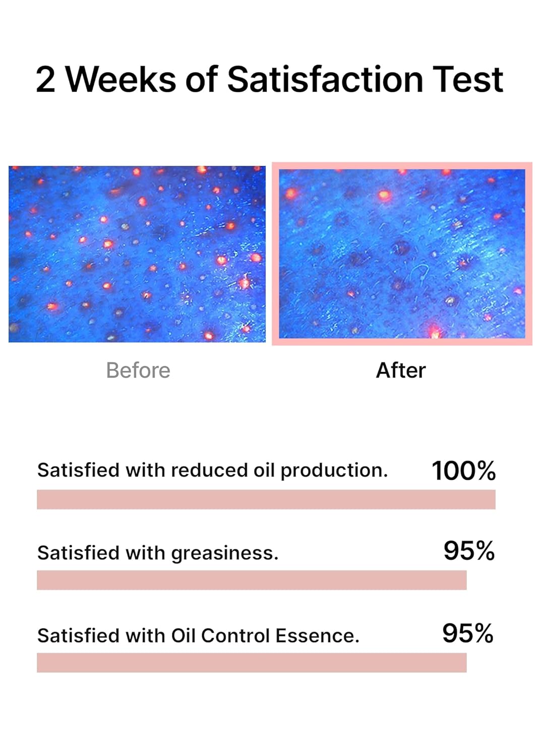CELIMAX Oil Control Capsule Essence 30ml