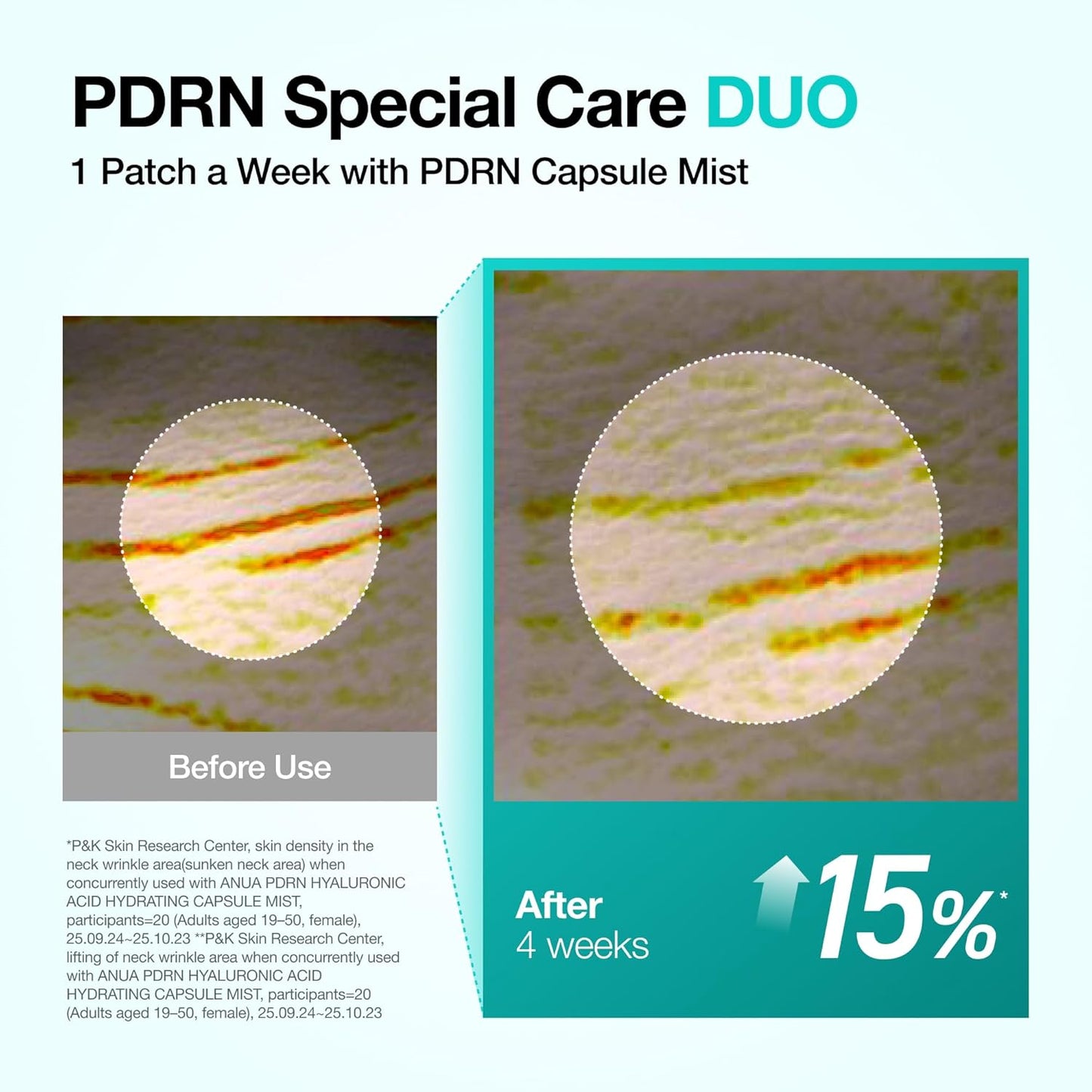 ANUA PDRN Collagen Melting Patch For Neck (4EA)