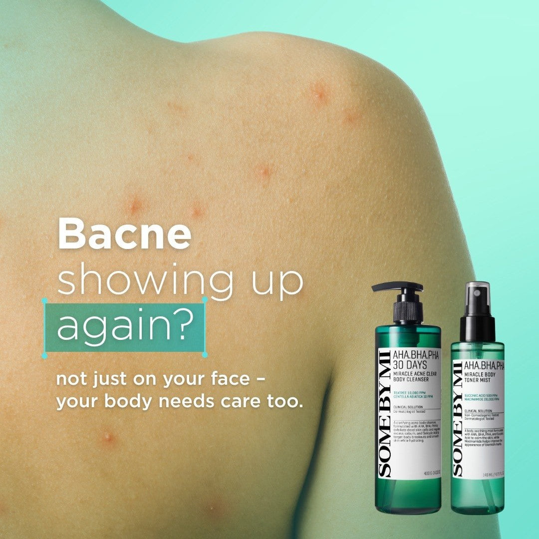 SOMEBYMI AHA BHA PHA 30Days Miracle Acne Clear Body Cleanser 400g