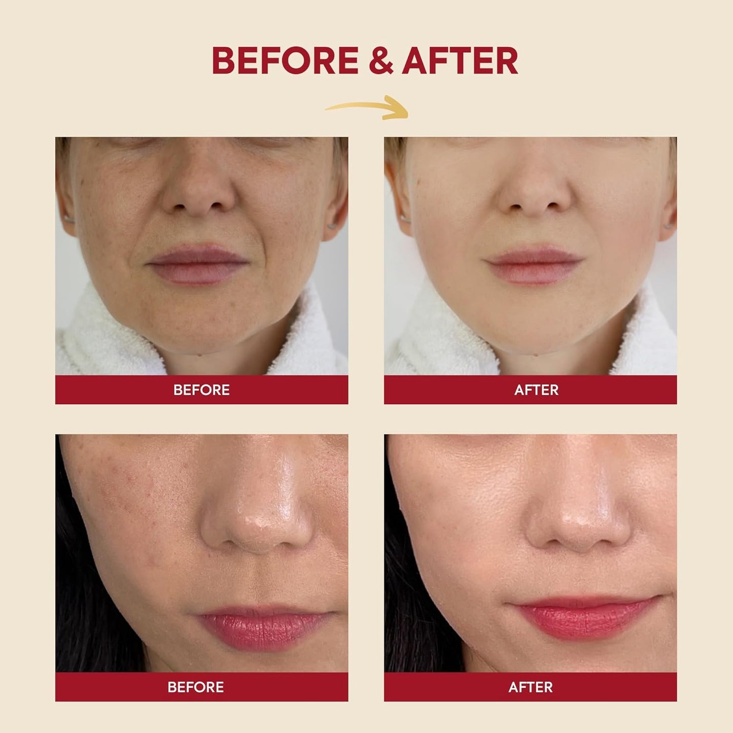 KSECRET Essence : Snail Mucin 97% + Rice 100ml