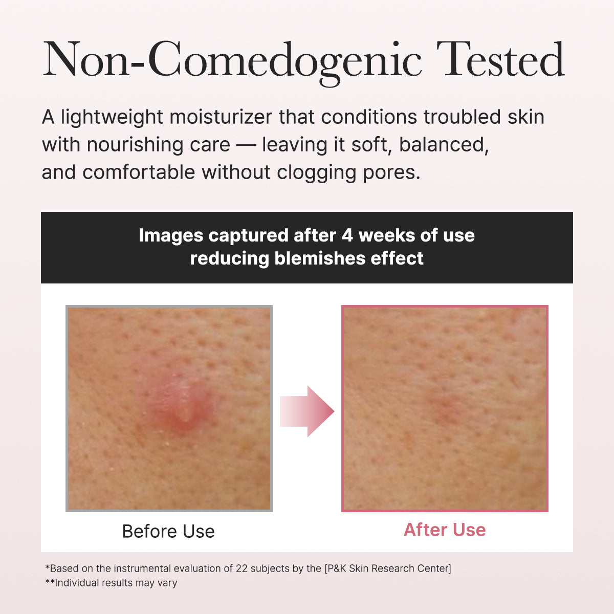 ARENCIA Red Smoothie Lotion 5 200ml