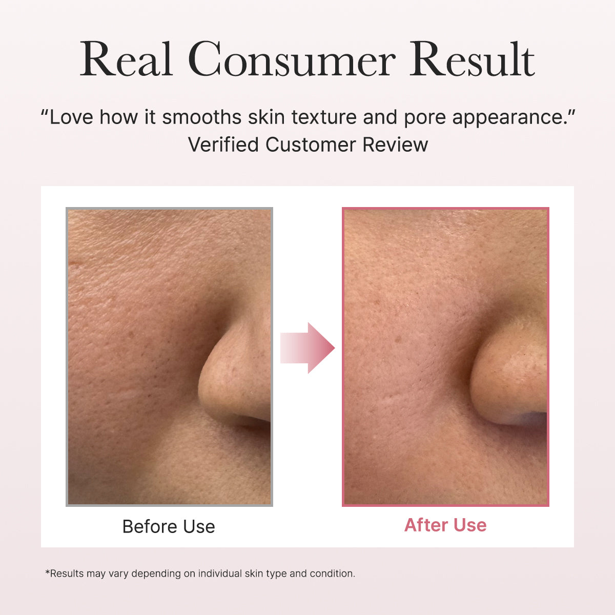 ARENCIA Red Smoothie Lotion 5 200ml