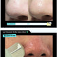 ILSO Super Melting Sebum Softener 150ml