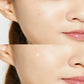 COSRX Acne Pimple Master Patch (24ea)